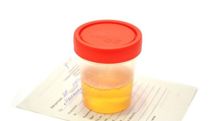 Mucus Threads In Urine Causes And Treatment 9520